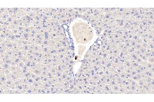 Detection of CRP in Mouse Liver Tissue using Polyclonal Antibody to C Reactive Protein (CRP) (CRP antibody  (AA 20-225))