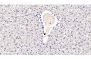 Detection of CRP in Mouse Liver Tissue using Polyclonal Antibody to C Reactive Protein (CRP) (CRP antibody  (AA 20-225))