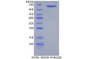 SDS-PAGE (SDS) image for FOS-Like Antigen 1 (FOSL1) (AA 1-275) protein (His tag,GST tag) (ABIN1879687) (FOSL1 Protein (AA 1-275) (His tag,GST tag))