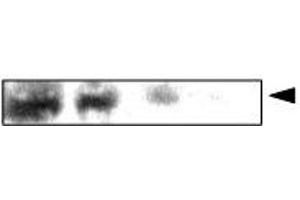 Western Blotting (WB) image for anti-Crystallin, alpha A (CRYAA) antibody (ABIN6245676) (CRYAA antibody)