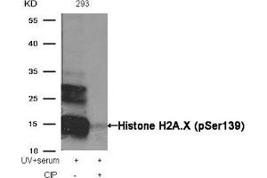 Western blot analysis of extracts from 293 cells, treated with UV+serum or calf intestinal phosphatase (CIP), using Histone H2A. (H2AFX antibody  (pSer139))