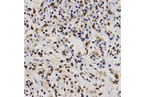 Immunohistochemistry (IHC) image for anti-Proline-, Glutamic Acid- and Leucine-Rich Protein 1 (PELP1) (AA 1021-1180) antibody (ABIN3023502) (PELP1 antibody  (AA 1021-1180))