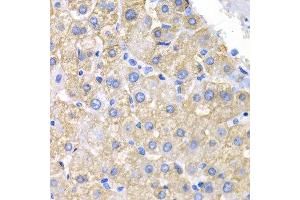 Immunohistochemistry (IHC) image for anti-V-Crk Sarcoma Virus CT10 Oncogene Homolog (Avian) (CRK) (AA 1-304) antibody (ABIN6218679) (Crk antibody  (AA 1-304))