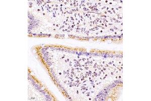 Immunohistochemistry of paraffin embedded mouse duodenum using ASBT (ABIN7075648) at dilution of 1:1500 (400x lens) (SLC10A2 antibody)