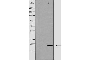 Western blot analysis of CD3 ζ (Phospho-Tyr142) expression in Jurkat cell lysate .