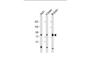 All lanes : Anti-PKC beta1/2 Antibody (Center) at 1:2000 dilution Lane 1: A431 whole cell lysate Lane 2: human brain lysate Lane 3: mouse brain lysate Lysates/proteins at 20 μg per lane. (PKC beta1/2 (AA 303-334) antibody)