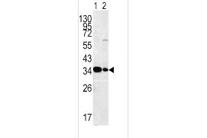 Western blot analysis of MPST antibody in HepG2 Lane 1 and Hela(lane2 ) cell line lysates (35ug/lane)