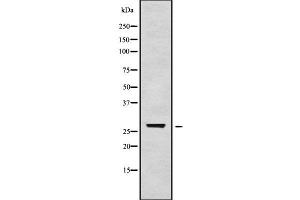 Western blot analysis of TGIF2LX using HepG2 whole cell lysates (TGIF2LX antibody)