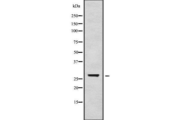 TGIF2LX antibody