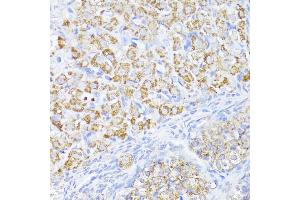 Immunohistochemistry of paraffin-embedded Rat ovary using MAVS antibody (ABIN6132297, ABIN6143583, ABIN6143584 and ABIN6221441) at dilution of 1:100 (40x lens).