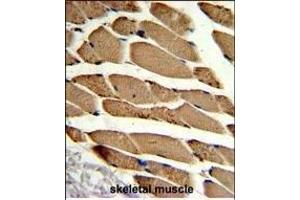 Formalin-fixed and paraffin-embedded human skeletal muscle reacted with ACTR2 Antibody (Center), which was peroxidase-conjugated to the secondary antibody, followed by DAB staining. (ACTR2 antibody  (AA 191-219))