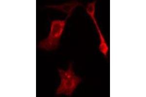 ABIN6277627 staining HeLa cells by IF/ICC. (Plakophilin 2 antibody  (N-Term))