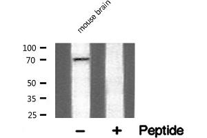 Western blot analysis of Adrenergic Receptor α-2C expression in mouse brain lysate (ADRA2C antibody  (Internal Region))