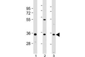 Western blot testing of 1) human 293T/17, 2) mouse brain and 3) human SH-SY5Y cell lysate with NAT8L antibody at 1:2000. (NAT8L antibody  (AA 59-93))