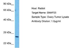 Host:  Rabbit  Target Name:  SNAP25  Sample Tissue:  Human Ovary Tumor  Antibody Dilution:  1ug/ml (SNAP25 antibody  (C-Term))