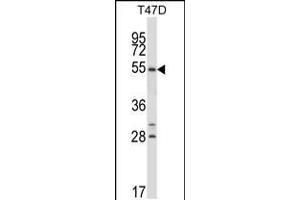 Western Blotting (WB) image for anti-Nuclear Receptor Subfamily 1, Group D, Member 1 (NR1D1) (AA 191-219) antibody (ABIN5531752)