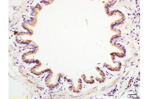 Formalin-fixed and paraffin embedded rat lung labeled with Anti-Anterior Gradient 2 Polyclonal Antibody, Unconjugated (ABIN710021) at 1:200 followed by conjugation to the secondary antibody and DAB staining. (AGR2 antibody  (AA 51-150))