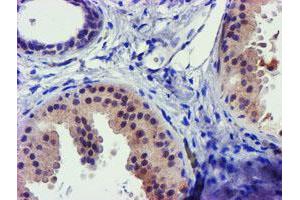 Immunohistochemical staining of paraffin-embedded Human breast tissue using anti-C1S mouse monoclonal antibody.
