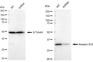 Western blotting analysis using Annexin A10 antibody (ABIN7797615). (Recombinant Annexin a10 antibody)