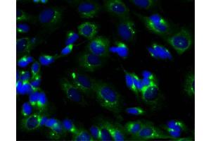 Immunofluorescent staining of SK-N-SH cells (right). (PRKAR2B antibody  (AA 1-418))