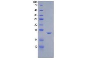 SDS-PAGE of Protein Standard from the Kit  (Highly purified E. (IL-2 ELISA Kit)