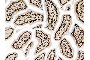 anti-Mitogen-Activated Protein Kinase Kinase Kinase 3 (MAP3K3) (pSer166) antibody