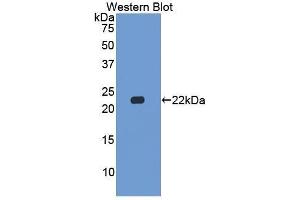 Western Blotting (WB) image for anti-Casein beta (CSN2) (AA 41-198) antibody (ABIN1867412)