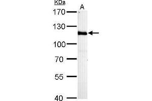 WB Image HGS antibody [C2C3], C-term detects HGS protein by Western blot analysis.