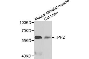 Western blot analysis of extracts of various cell lines, using TPH2 antibody. (Tryptophan Hydroxylase 2 antibody)