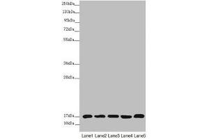 NDUFB5 antibody  (AA 100-189)