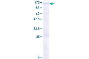 EPS8 Protein (AA 1-822) (GST tag)