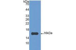 Western blot analysis of recombinant Chicken IL4. (IL-4 antibody  (AA 26-136))