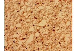 Immunohistochemistry of paraffin-embedded human brain tissue using ABIN7159092 at dilution of 1:100 (TMEM67 antibody  (AA 241-500))