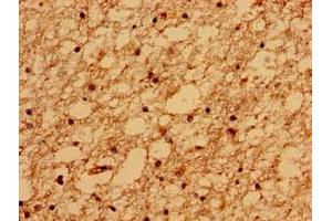 Immunohistochemistry of paraffin-embedded human brain tissue using ABIN7159092 at dilution of 1:100