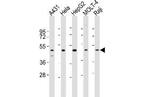 All lanes : Anti-CYP24A1 Antibody (N-term) at 1:2000 dilution Lane 1: A431 whole cell lysates Lane 2: Hela whole cell lysates Lane 3: HepG2 whole cell lysates Lane 4: MOLT-4 whole cell lysates Lane 5: Raji whole cell lysates Lysates/proteins at 20 μg per lane. (CYP24A1 antibody  (N-Term))