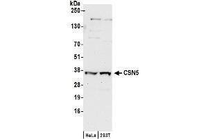 Western Blotting (WB) image for anti-COP9 Constitutive Photomorphogenic Homolog Subunit 5 (Arabidopsis) (COPS5) (AA 175-225) antibody (ABIN7449381) (COPS5 antibody  (AA 175-225))