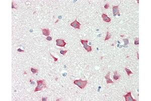 Immunohistochemistry (IHC) image for anti-Ribosomal Protein S6 Kinase, 70kDa, Polypeptide 2 (RPS6KB2) (AA 300-350) antibody (ABIN2627766)