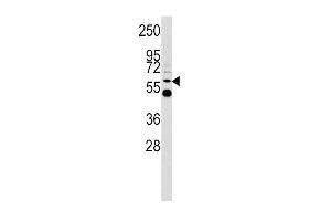 Western blot analysis of UDB17 antibody (Center) (ABIN390399 and ABIN2840791) in Y79 cell line lysates (35 μg/lane). (UGT2B17 antibody  (AA 119-147))