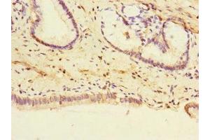 PTPN4 antibody  (AA 1-240)