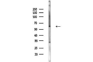 anti-Fukutin (FKTN) (Internal Region) antibody