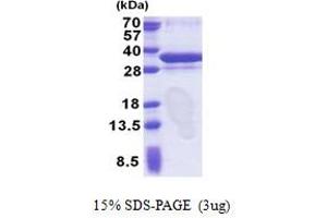 SDS-PAGE (SDS) image for Origin Recognition Complex, Subunit 6 (ORC6) (AA 1-252) protein (His tag) (ABIN6387302)