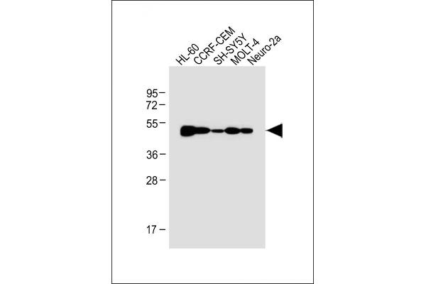 BLMH anticorps  (AA 212-242)
