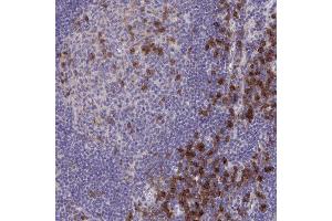 Immunohistochemical staining (Formalin-fixed paraffin-embedded sections) of human lymph node with SLAMF7 polyclonal antibody  shows strong cytoplasmic positivity in germinal center cells and non-germinal center cells. (SLAMF7 antibody  (AA 253-323))