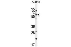 CCDC148 Antibody (Center) western blot analysis in A2058 cell line lysates (35µg/lane). (CCDC148 antibody  (Middle Region))