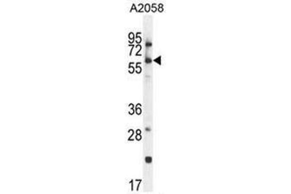 CCDC148 antibody  (Middle Region)