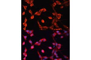 Immunofluorescence analysis of NIH-3T3 cells using  Polyclonal Antibody (ABIN6129875, ABIN6136541, ABIN6136542 and ABIN6224558) at dilution of 1:100 (40x lens). (ADAMTS13 antibody  (AA 1300-1400))