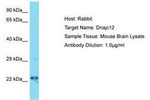 Image no. 1 for anti-DnaJ (Hsp40) Homolog, Subfamily C, Member 12 (DNAJC12) (AA 31-80) antibody (ABIN6750387)