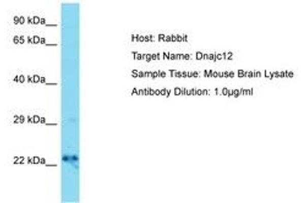 DNAJC12 antibody  (AA 31-80)