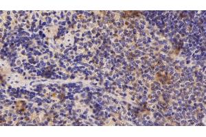 Detection of ADRM1 in Rat Spleen Tissue using Polyclonal Antibody to Adhesion Regulating Molecule 1 (ADRM1) (ADRM1 antibody  (AA 2-407))