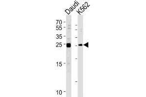 Western Blotting (WB) image for anti-MOB Kinase Activator 1B (MOB1B) antibody (ABIN3002948) (MOBKL1A antibody)